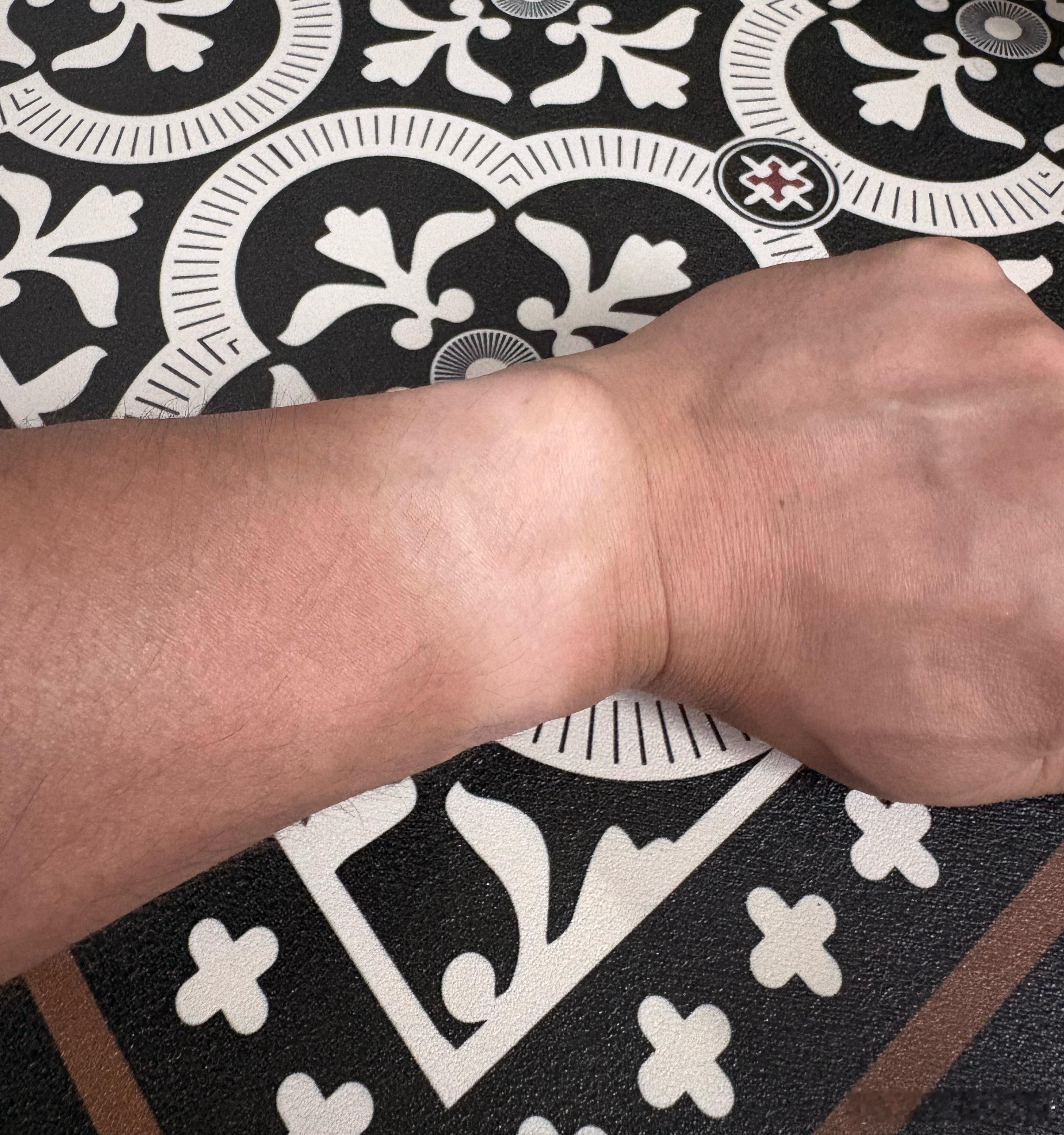 生活手记这是跑者的标志吗？[捂脸哭]跑步​​​