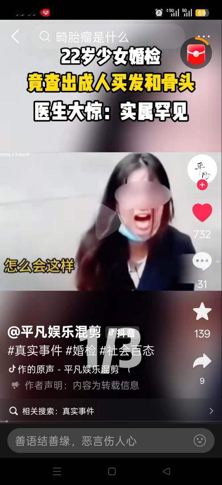 世界真是魔幻至极！一位22岁的女子在婚前体检时，竟被查出卵巢里有大量毛发和骨头。