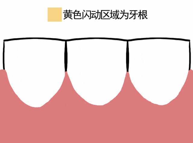 十人九塞牙？6月11日报道，吃完饭牙缝卡菜卡肉，抠半天抠不出来，随手拿竹牙签剔干