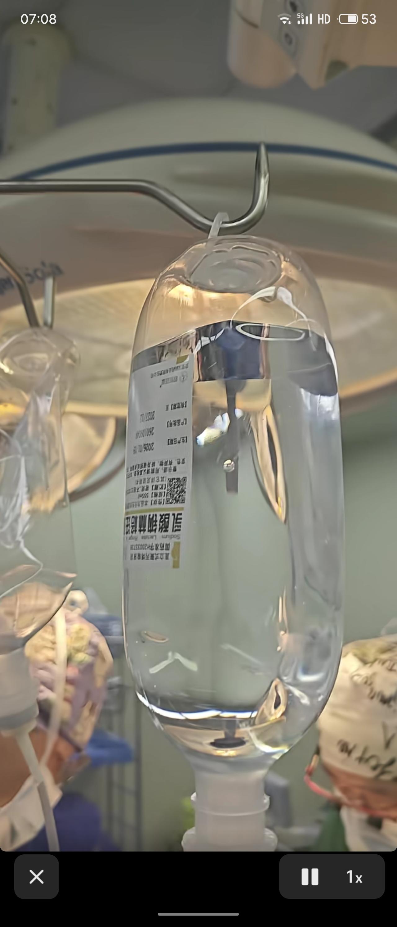 集采后500ml的补液常规药乳酸纳林格液1.6元，还不如一瓶农夫山泉。同时他的生