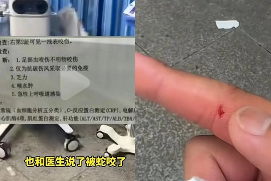 别急着骂三亚接诊被蛇咬女子的医生，看完这个你可能会有不同想法