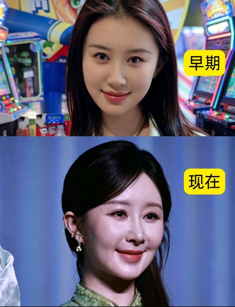 舒畅的脸这是怎么了？舒畅活动生图状态引发巨大争议，同台宋佳形成鲜明对比。镜头里面部饱满僵硬，不少网友