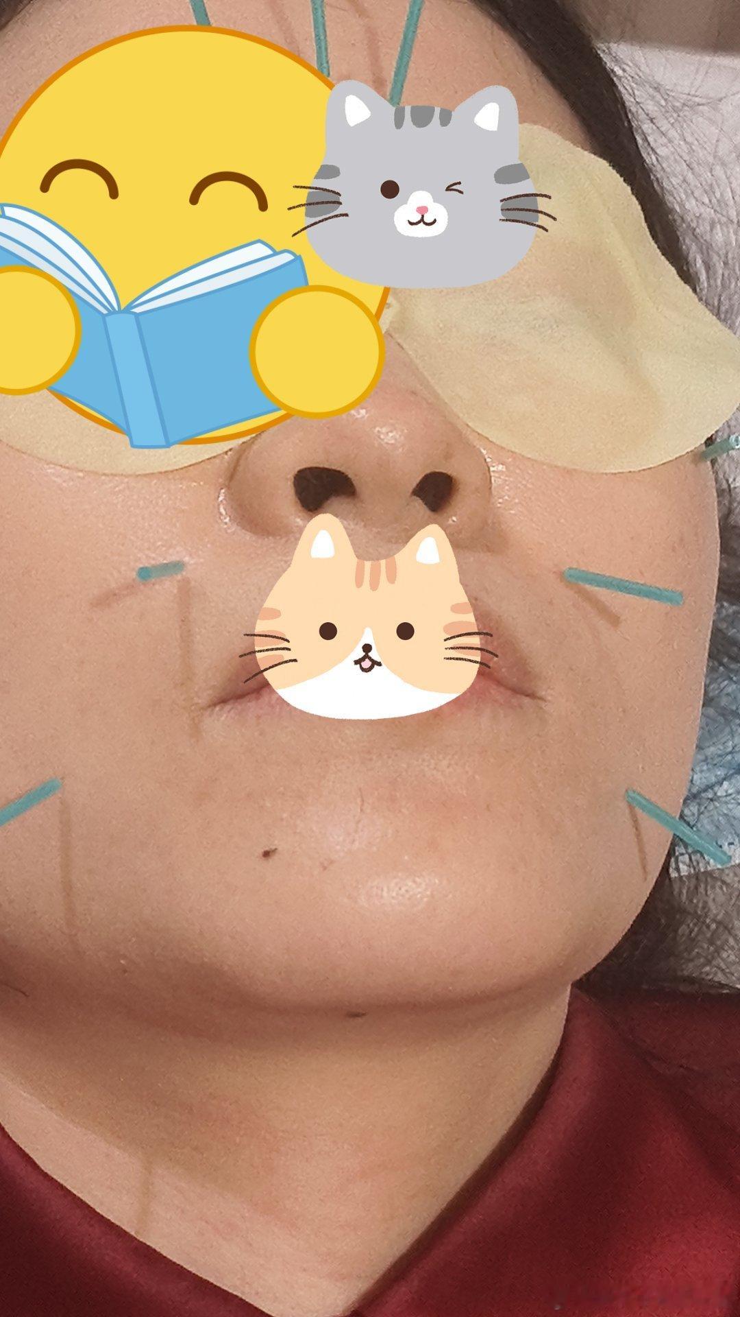日常碎片plog你好同学冒个泡下午门诊比较清闲，鼻炎，脾胃病，失眠，焦虑症，腺