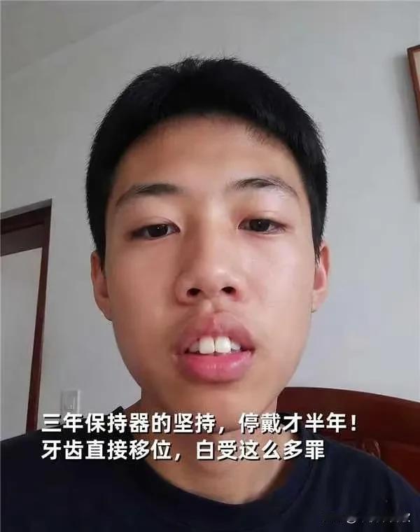 真的求求医生别再骗未成年说戴两年保持器就稳了😭弟弟16岁开始正畸，熬完三年钢牙