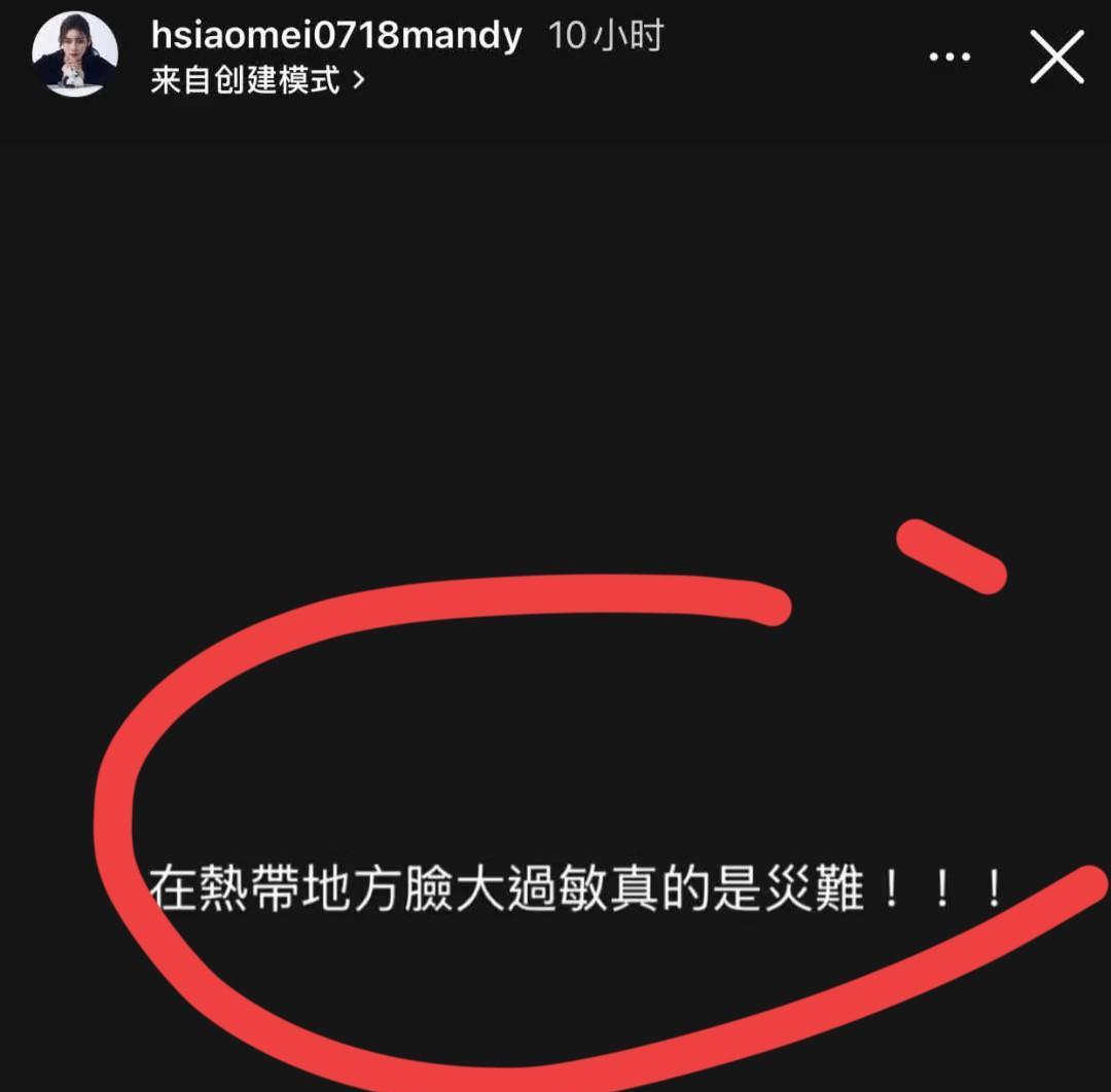 可怜的马筱梅啊深夜更新自己账号，无奈的吐槽：在热带地方脸大还过敏真是大难！看