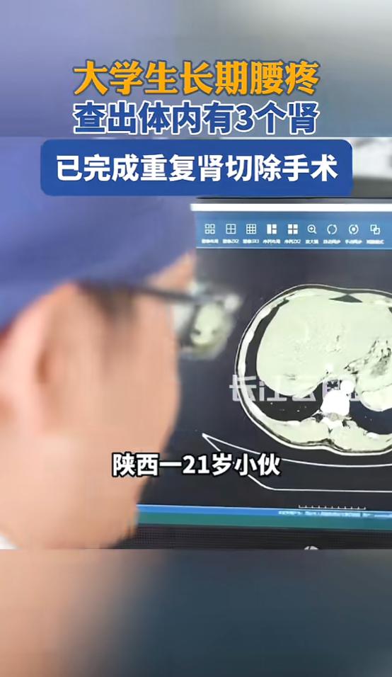 “真是开眼了！”7月23日报道，陕西，一小伙身体右侧偶尔腰痛、腹痛，在学校检查时