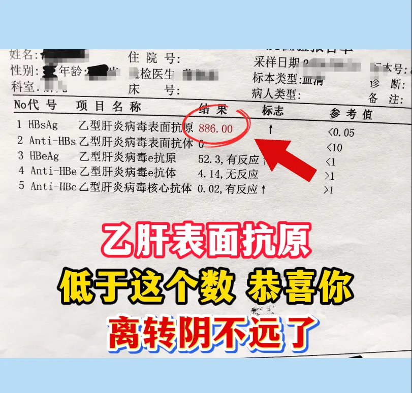 乙肝表面抗原是判断乙肝病毒感染和治疗效果的核心指标之一，检测值低于 1...