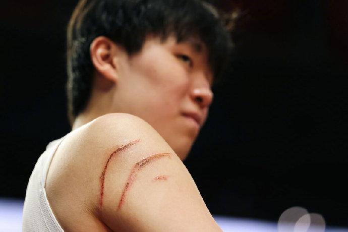 杨瀚森被挠了2个血印子！对阵火箭的比赛，杨瀚森出战了16分31秒，拿下3分3