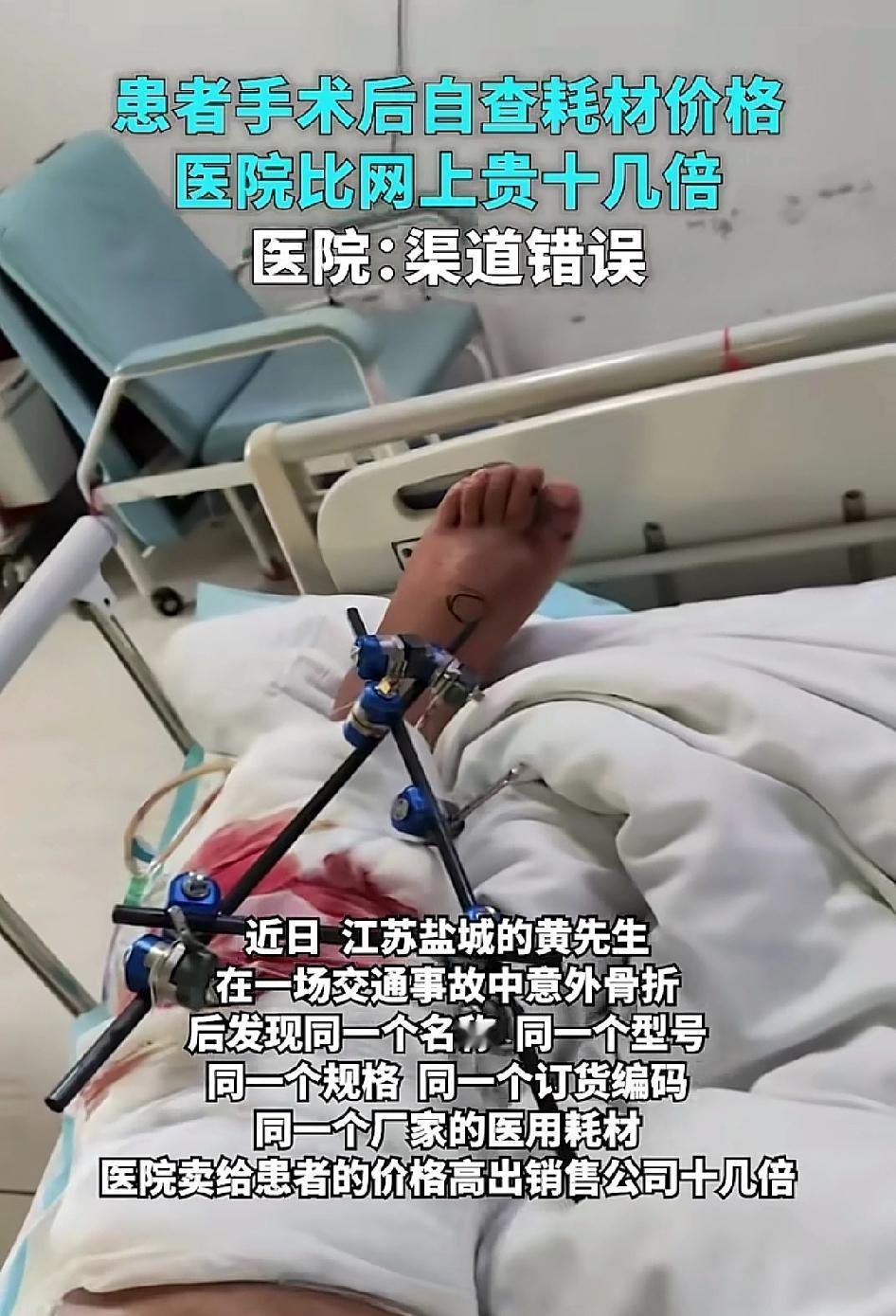 140元的东西到医院里变成2200元,去反映问题他们又把价格调成895元。江苏