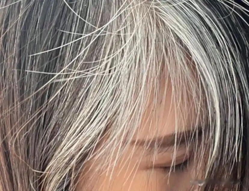 【压力致白头可逆？科学：别慌！解压后头发能黑回来】最新研究颠覆认知：白发并非不