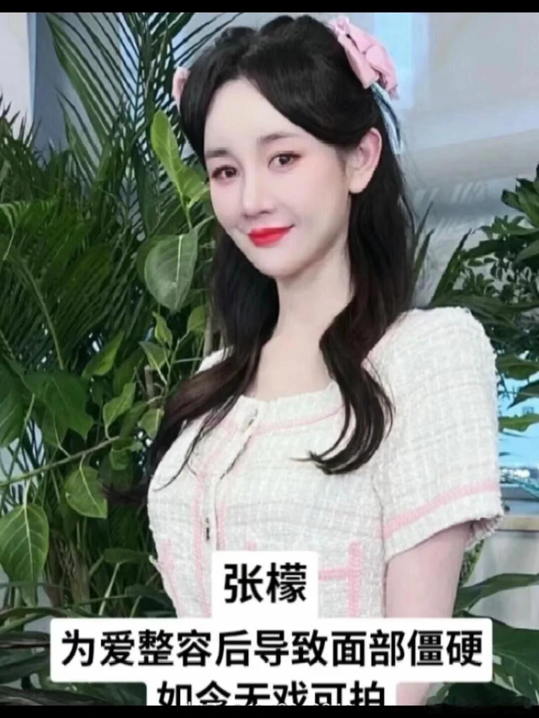 因不幸毁容的明星，最后一个太可惜了