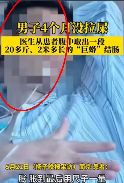一名男子4个月没拉屎，憋到不行，只能去医院医生划开他肚子的瞬间，弹出来的肠子把