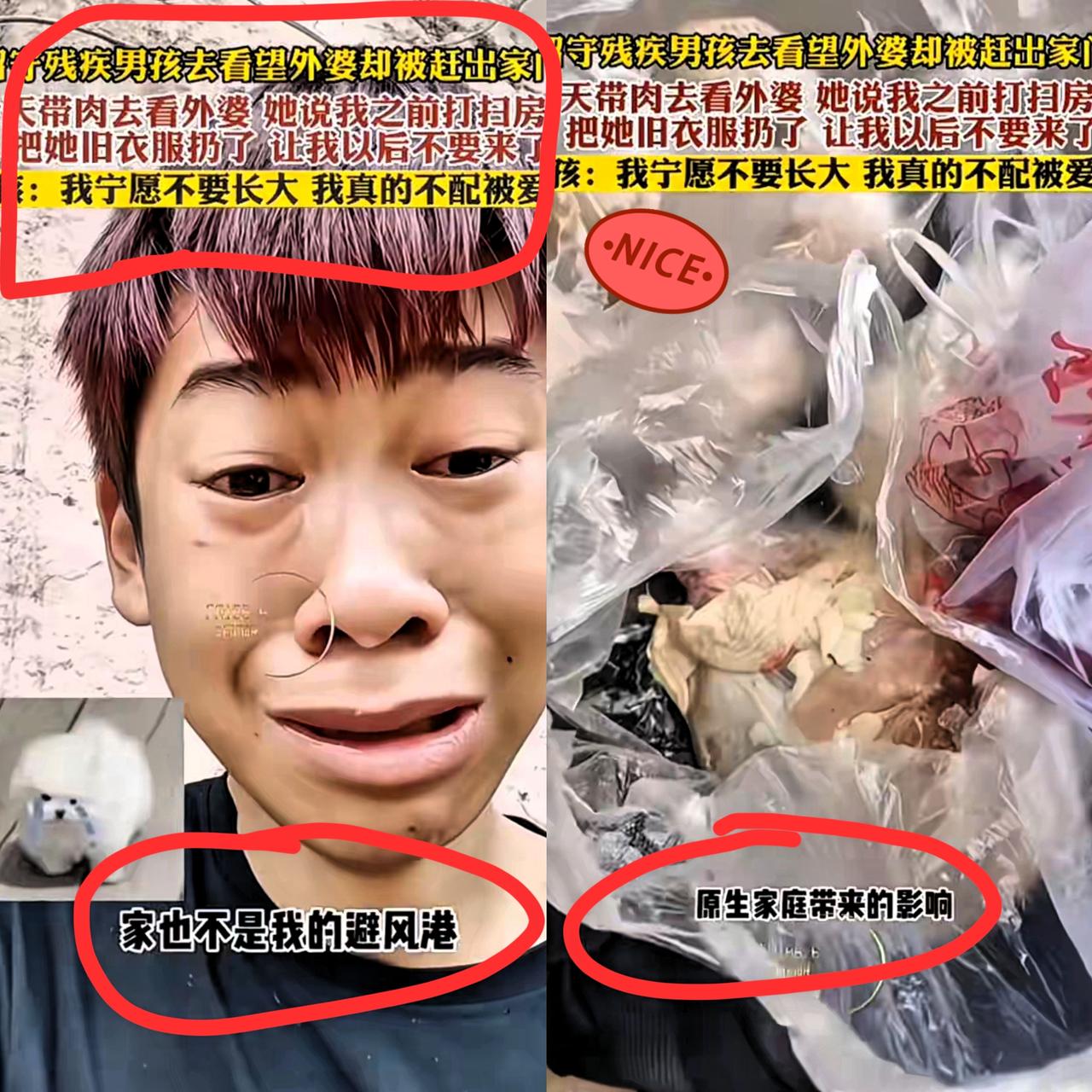 留守残疾男孩去看望外婆却被赶出家门!真的瞬间鼻子一酸,右手不便的他带着肉去看外