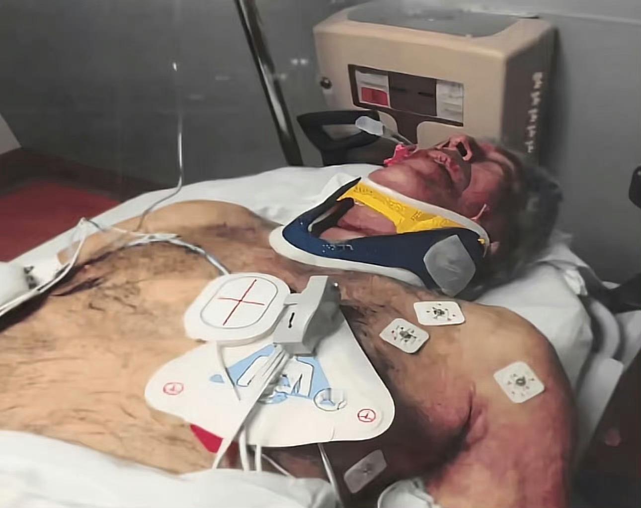 （图一）是爱泼斯坦精心制造的勒死自己的用狱衣布料制造的条状物，然后他"自杀"时不