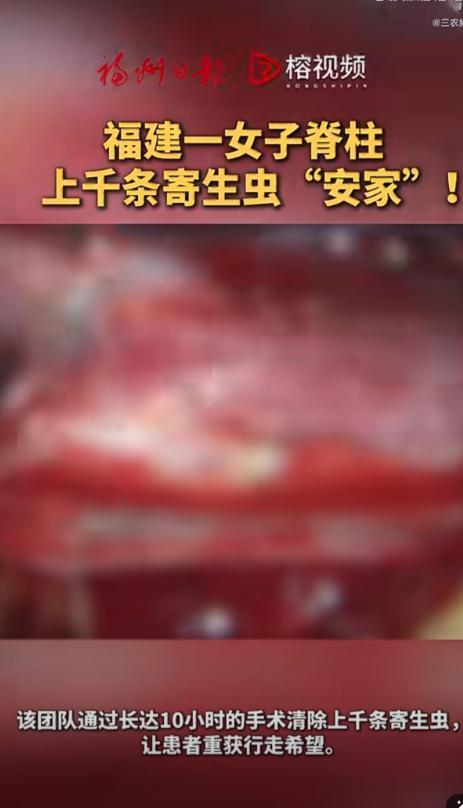 光明网5月16日报道，福建福州发生了一起罕见的医疗事件，一位57岁的农村妇女李女