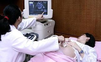 孕妇产检医生告诉无胎心, 回到家宝宝奇迹的在孕妇肚子中动了