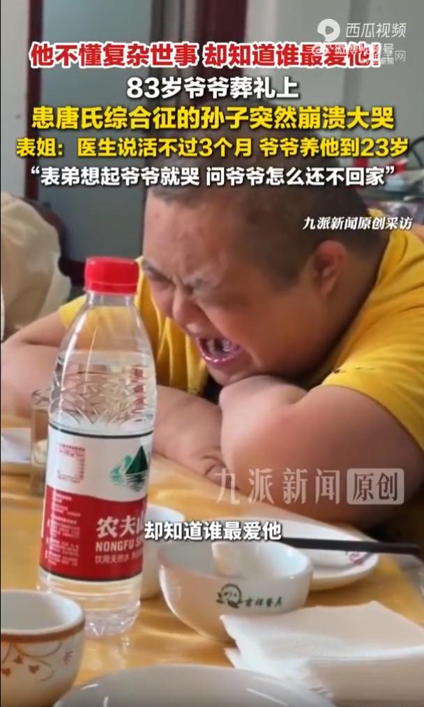 破防了！山东济宁，一个小伙是唐氏综合征，刚出生就被医生宣判活不过三个月，父母将他