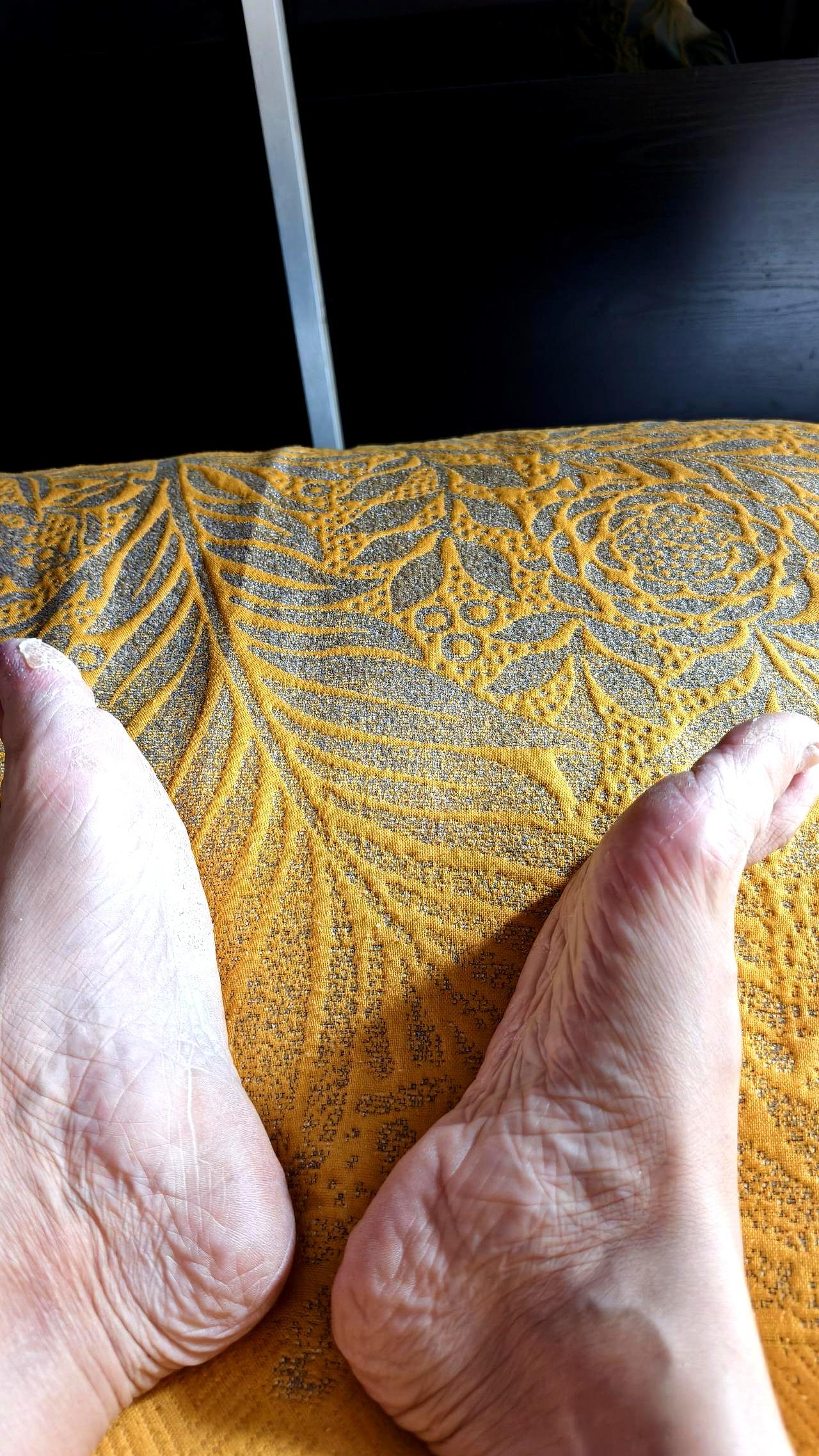 但不要过量运动远动和不运动差别很大他因为半月板撕裂，不得不静养了