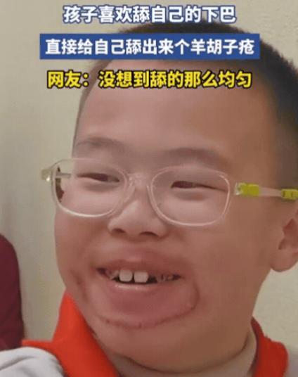 笑不活！浙江一男孩喜欢舔自己下巴，家长也没在意，觉得就是小孩闲得慌，结果，过一段
