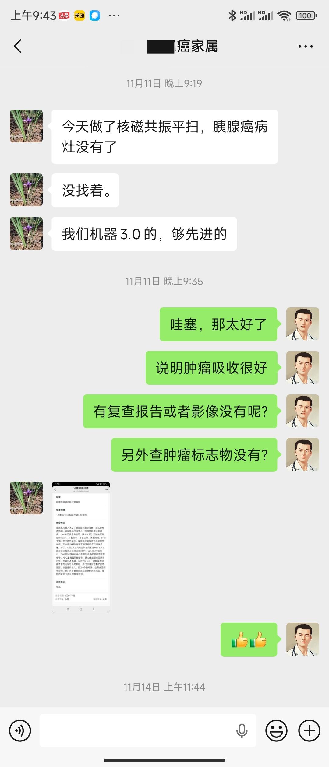 胰腺癌手术不能切除怎么办?胰头癌最常见的症状就是梗阻性黄疸，大多数患者可以经过胆