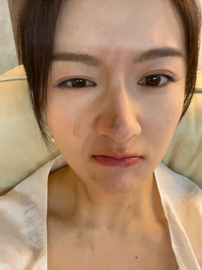 李兰迪怼脸自拍的神😉