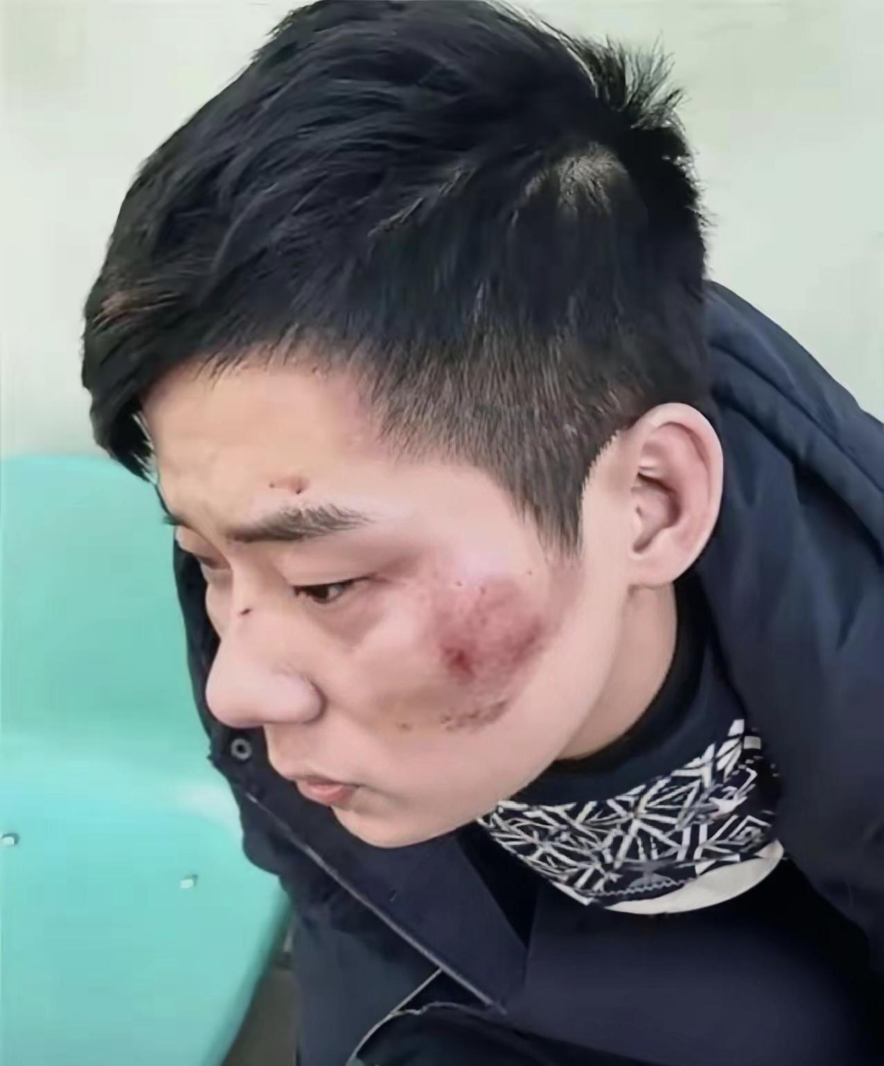 凌晨的四川广元，一名男子被多人追打，慌不择路直奔武警营门自卫哨求救。生死关