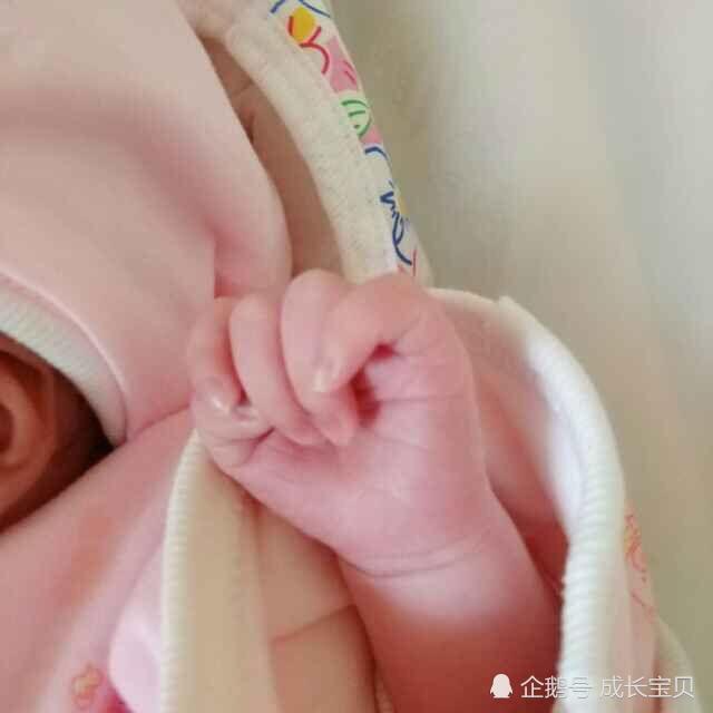 是该选择顺产? 还是剖腹产?