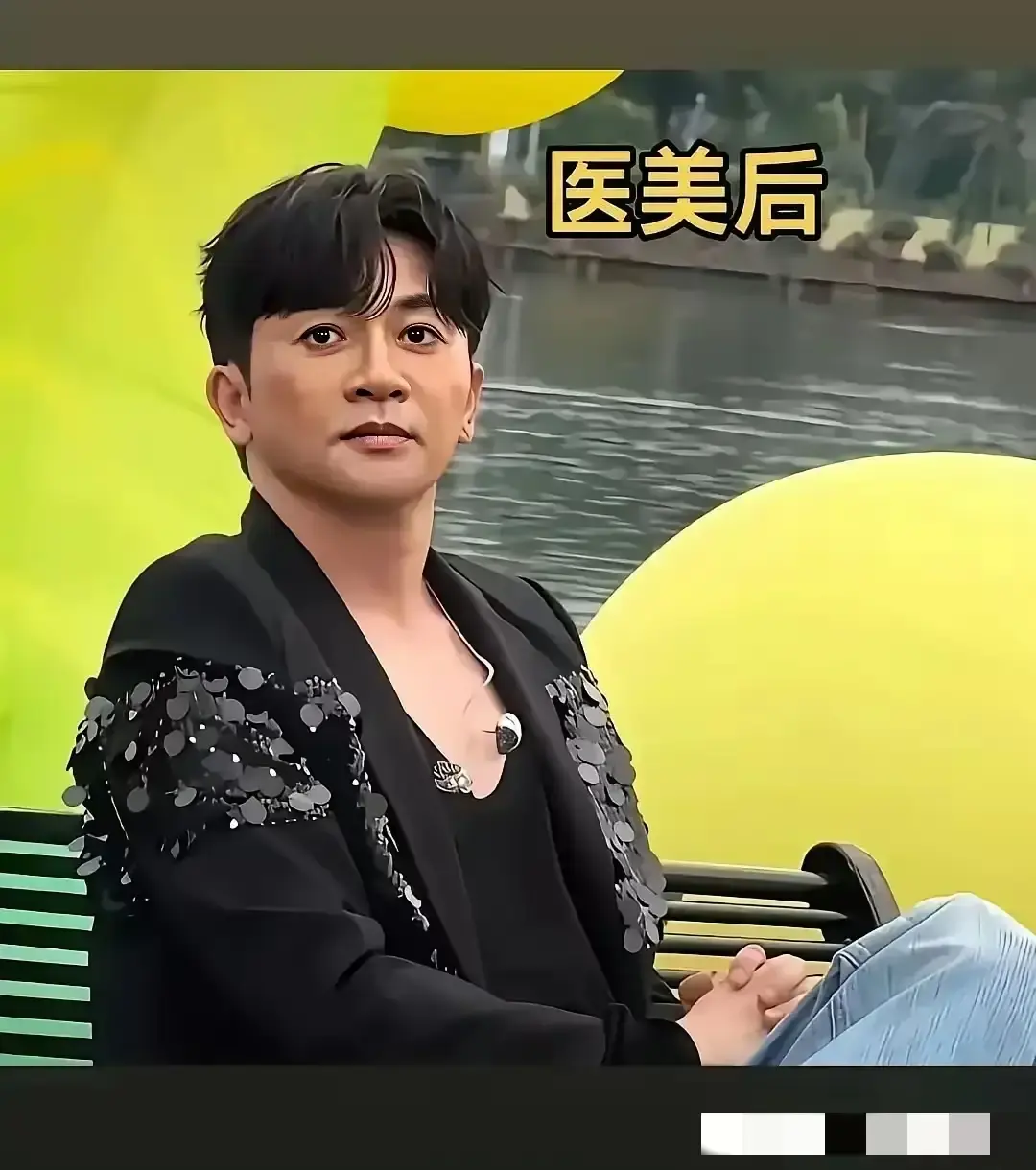 苏有朋整容争议：旧貌难寻引热议