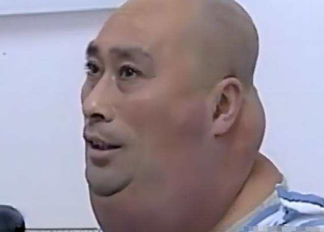 这一幕看着确实吓人。2013年，辽宁男子李秋武裹着厚厚的围巾来到沈阳就医，围巾解