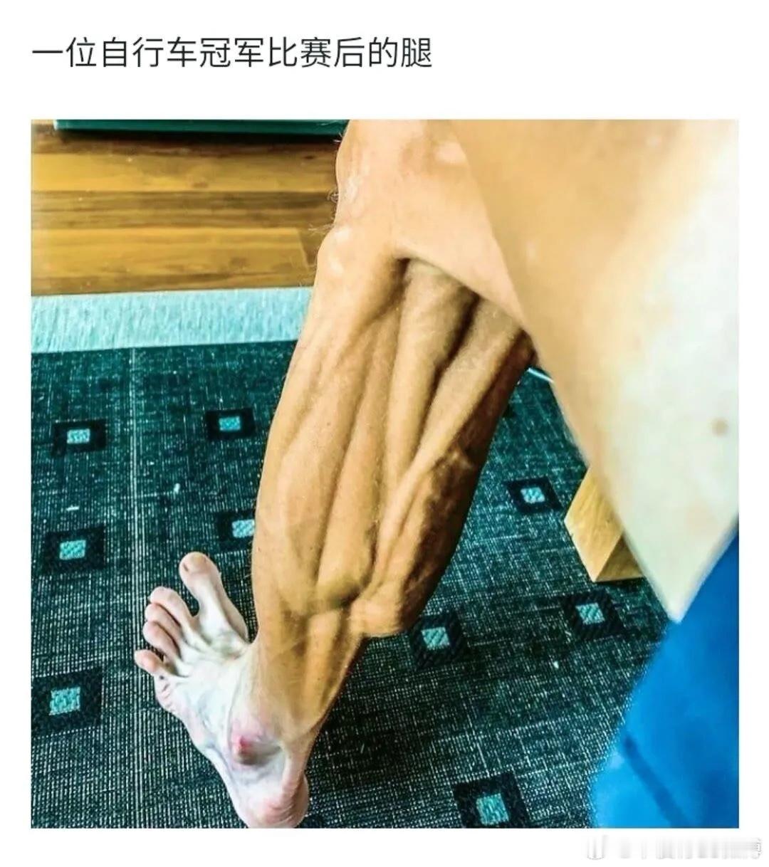 为什么运动员的腿会变成这样？​​​