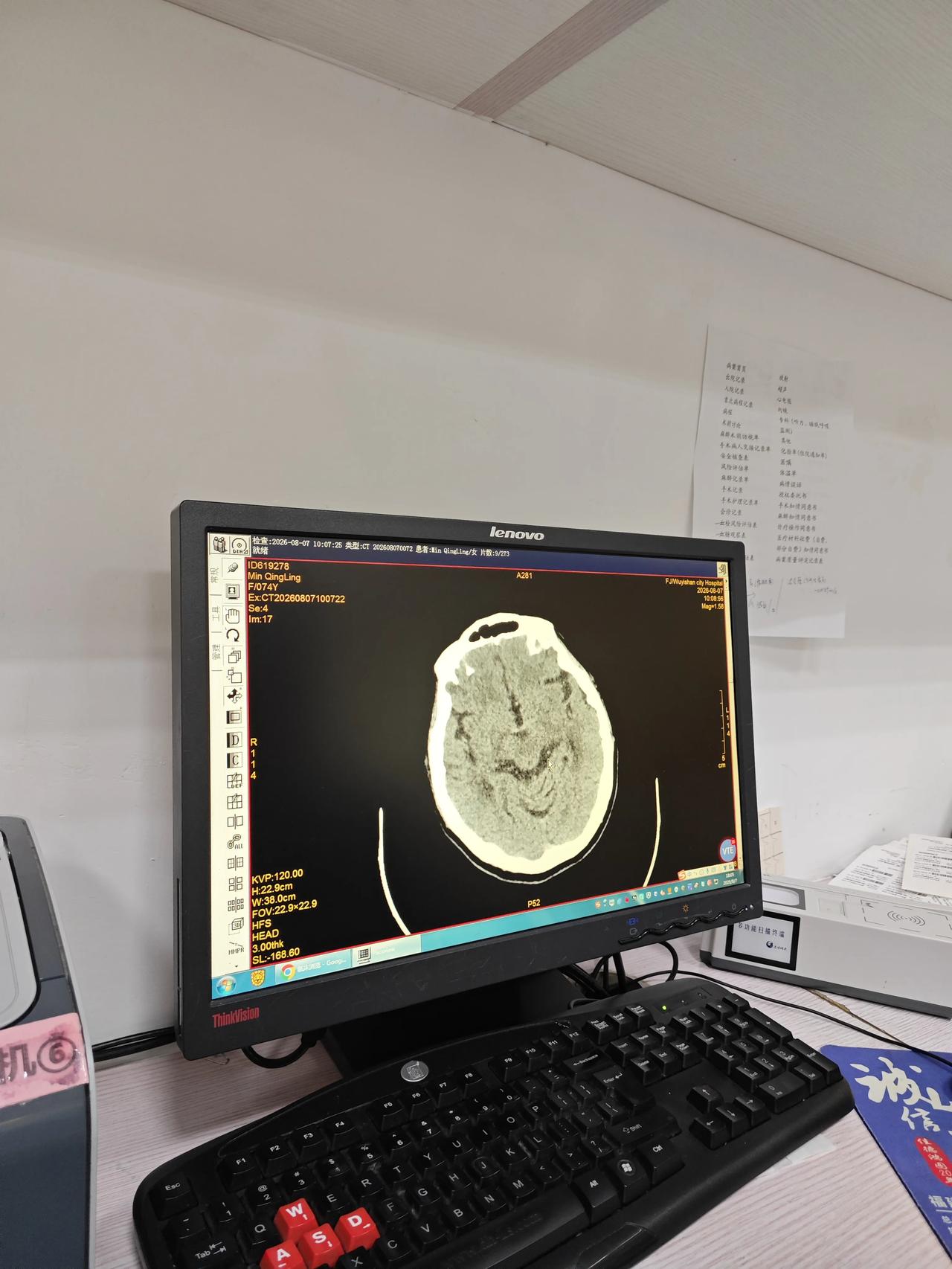 非必要不做CT！研究表明：一次CT检查辐射，可能埋下多年后的隐患我是“