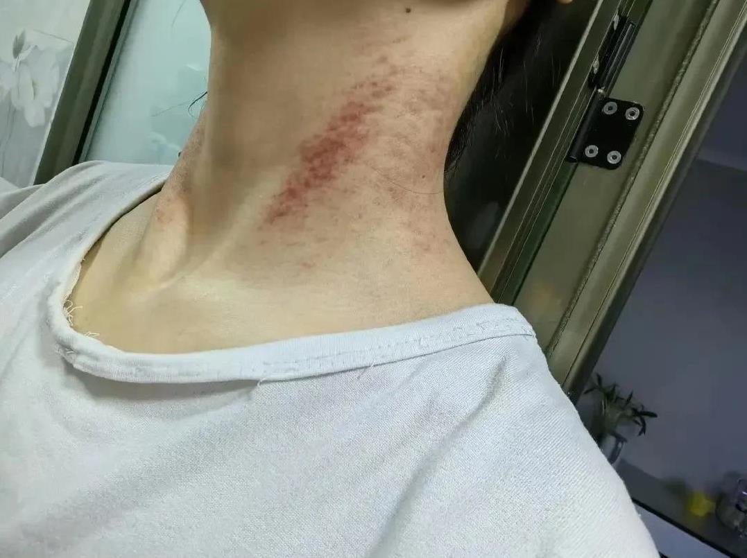 西安被害女护士的故事告诉我们，越是服从度高性格软弱的女孩越容易被欺负，这起悲剧中
