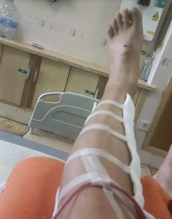 “这下后悔了吧！”9月1日，湖南益阳，一男子被钉子扎伤脚后，由于担心花钱，他并没