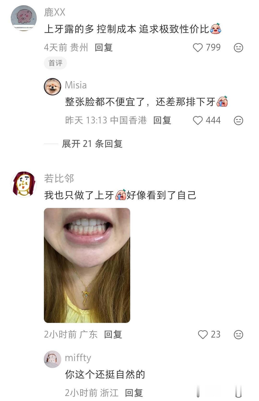 牙贴面只贴上牙