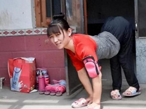 🐰山东莒县有个叫董明英的女人，打生下来就和别人不一样——先天骨盆畸形，