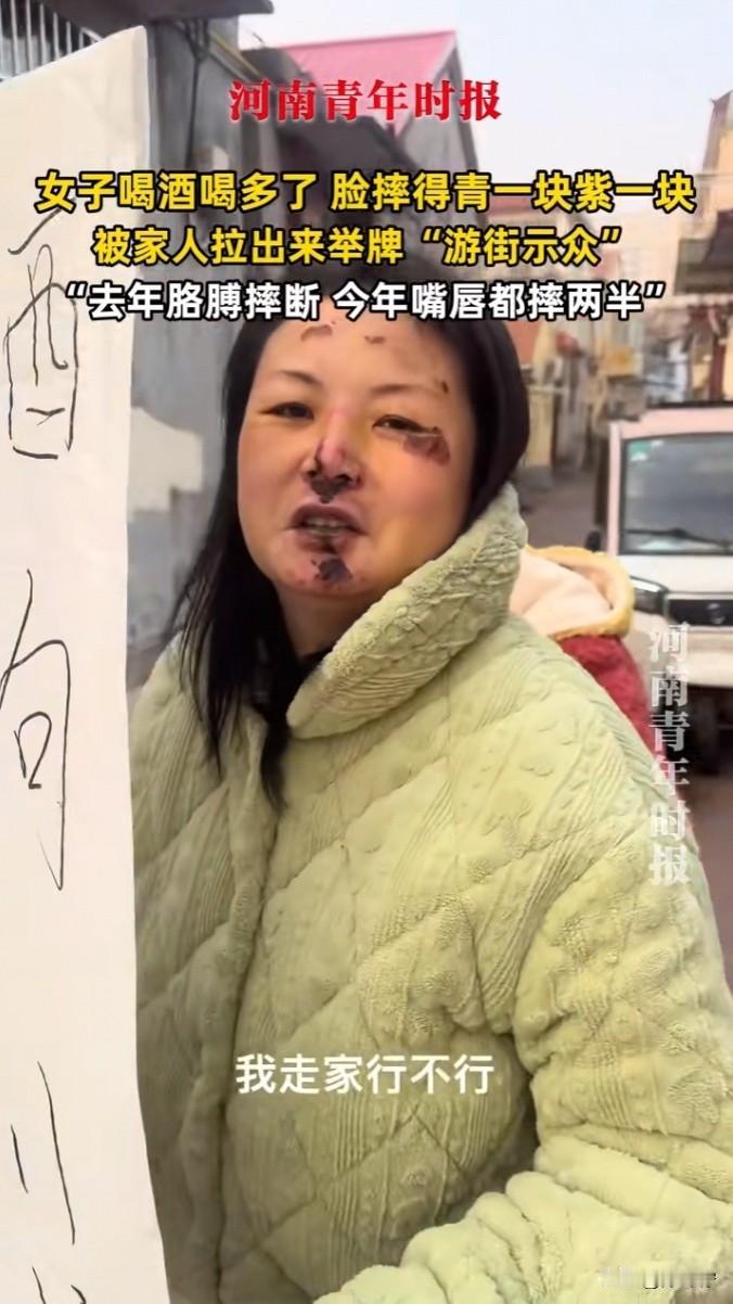 这一幕好笑又心酸！一女子爱喝酒、却没分寸，没想到这次喝大了，把脸直接摔成猪头样，