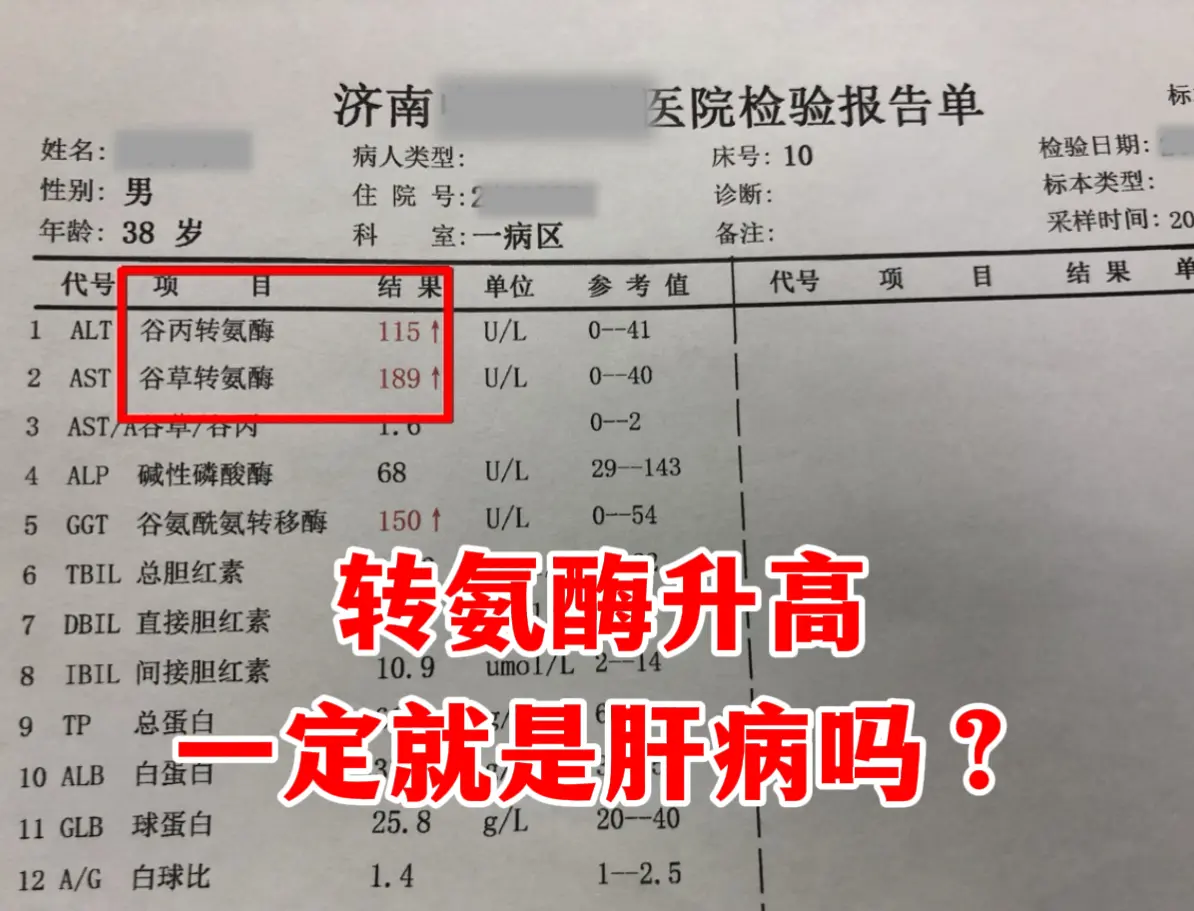 今天一位患者这样问，转氨酶高一定是肝病吗？不一定！ 但是像这位患者一样...