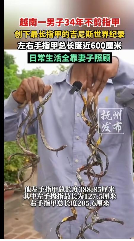 真的是林子大了，什么鸟都有！越南一男子34年不剪指甲，创下最长指甲的吉尼斯世界纪