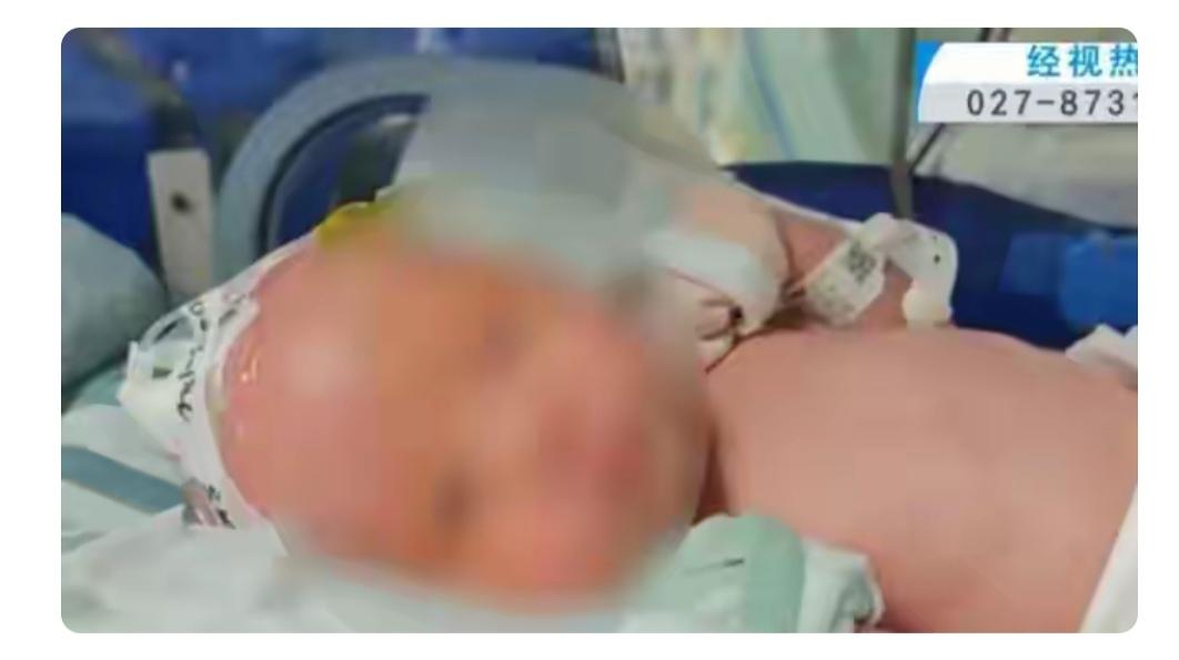 月嫂照顾孩子的时候，有一对双胞胎小男孩，因为月嫂太困了，在给孩子拍嗝的时候打瞌睡