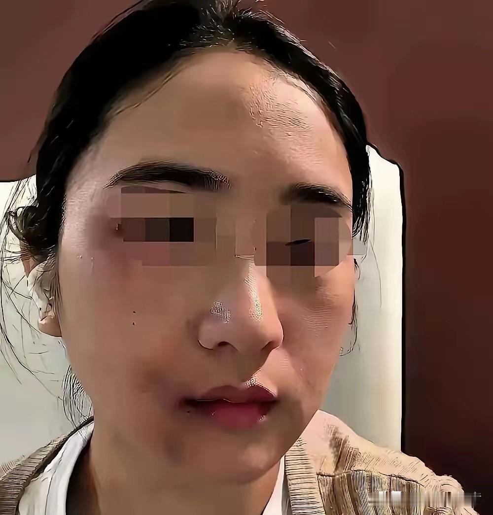 丈夫家暴妻子近十年，刚动手打完妻子三天，自己就确诊肝癌晚期，家人逼迫女方拿出全部