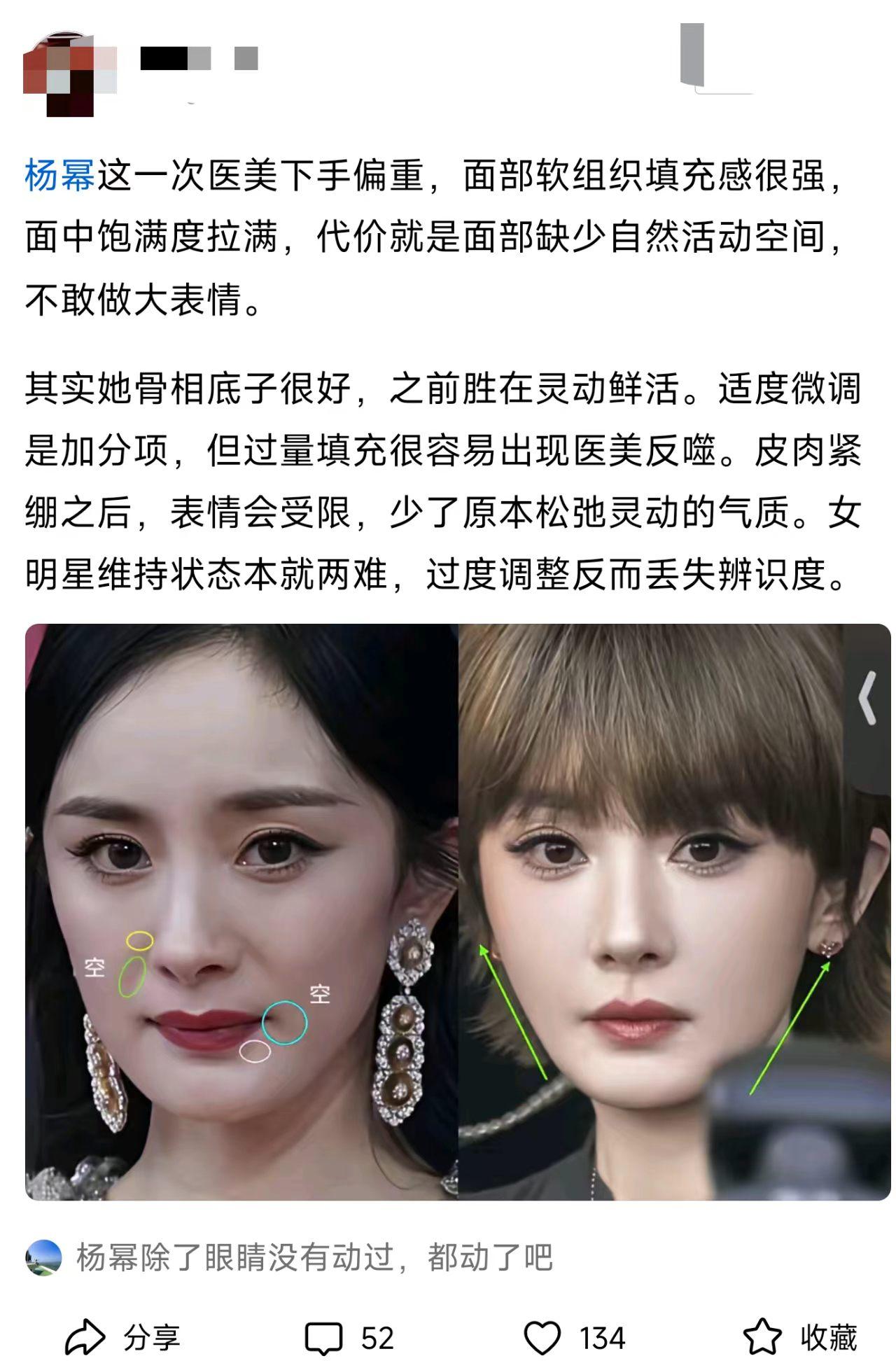明星医美这条路，是不是都走偏了？