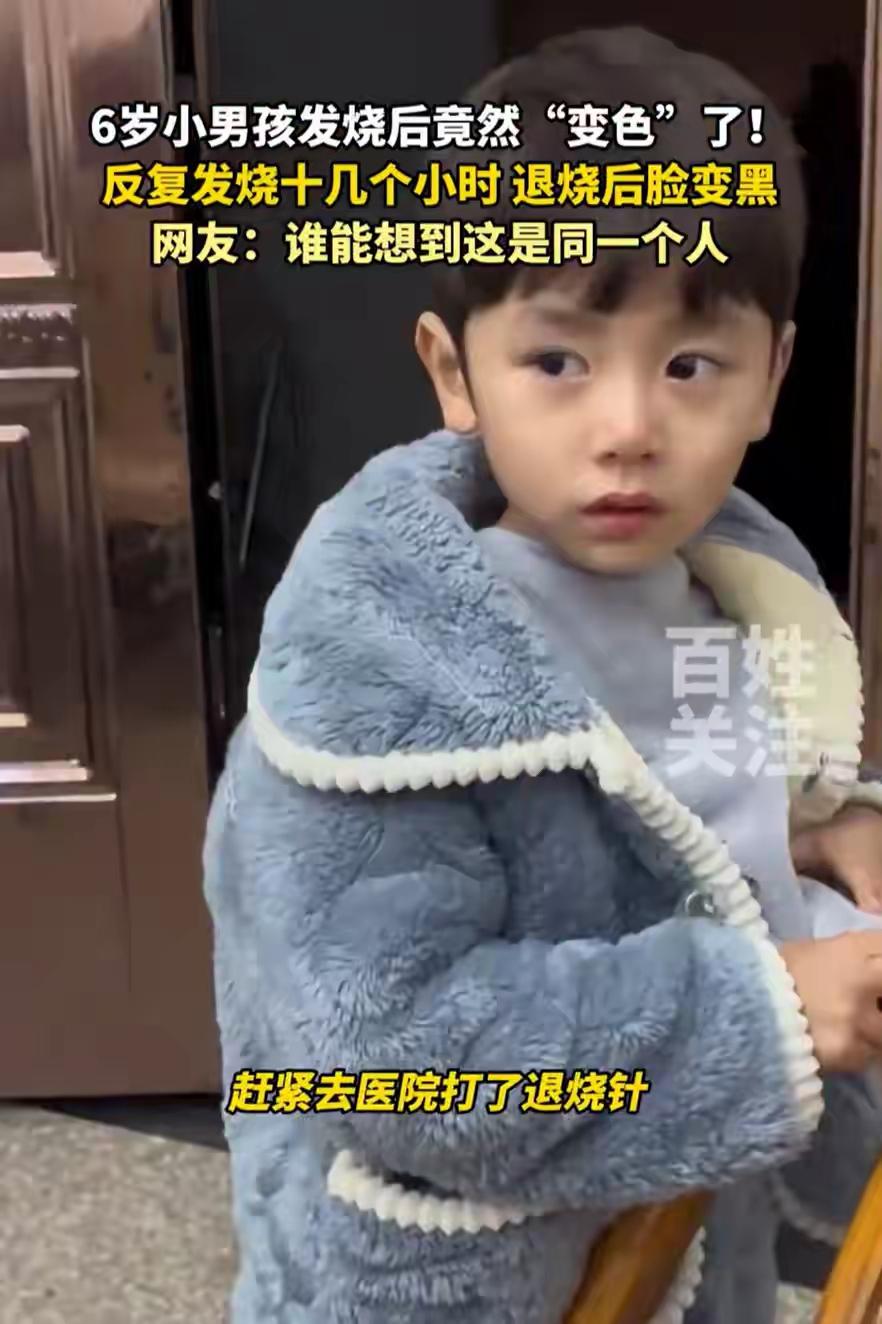 【男孩发烧十几小时退烧后脸变黑，背后的原因令人警醒！】近日，一则令人揪心的新