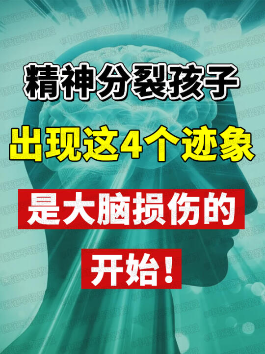 精神分裂孩子，出现这4个迹象，是大脑损伤的开始！ 	 ﻿精神分裂﻿ ﻿...