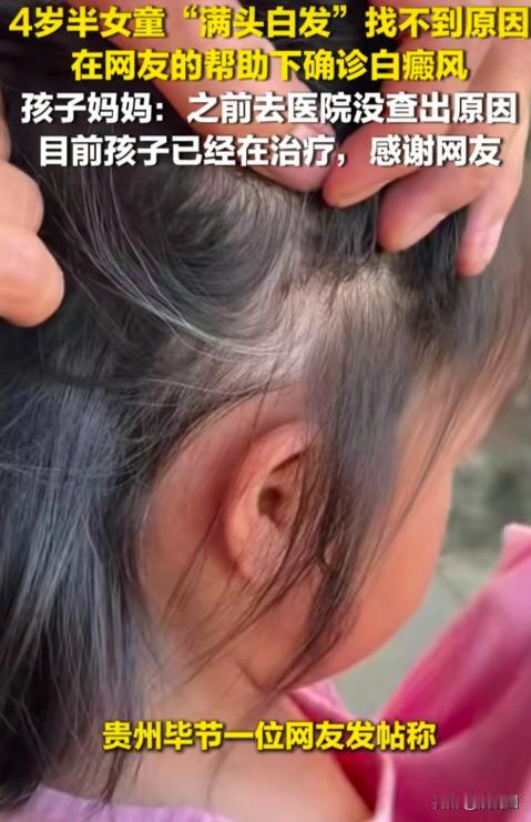 近日，贵州一位宝妈发帖求助，自己4岁女儿出现了大量白发，医院检查不出，却被网友一