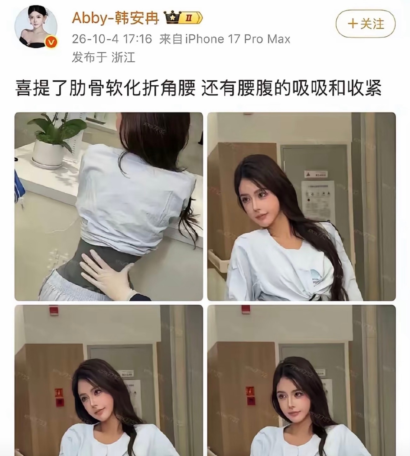 韩安冉极端医美刷到有网友分享对韩安冉医美的看法，觉得这样的医美有些过分，但也