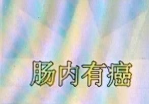 上完厕所，很多人都直接冲水，觉得大便又脏又臭没啥好看的。但其实，大便可是肠道健康