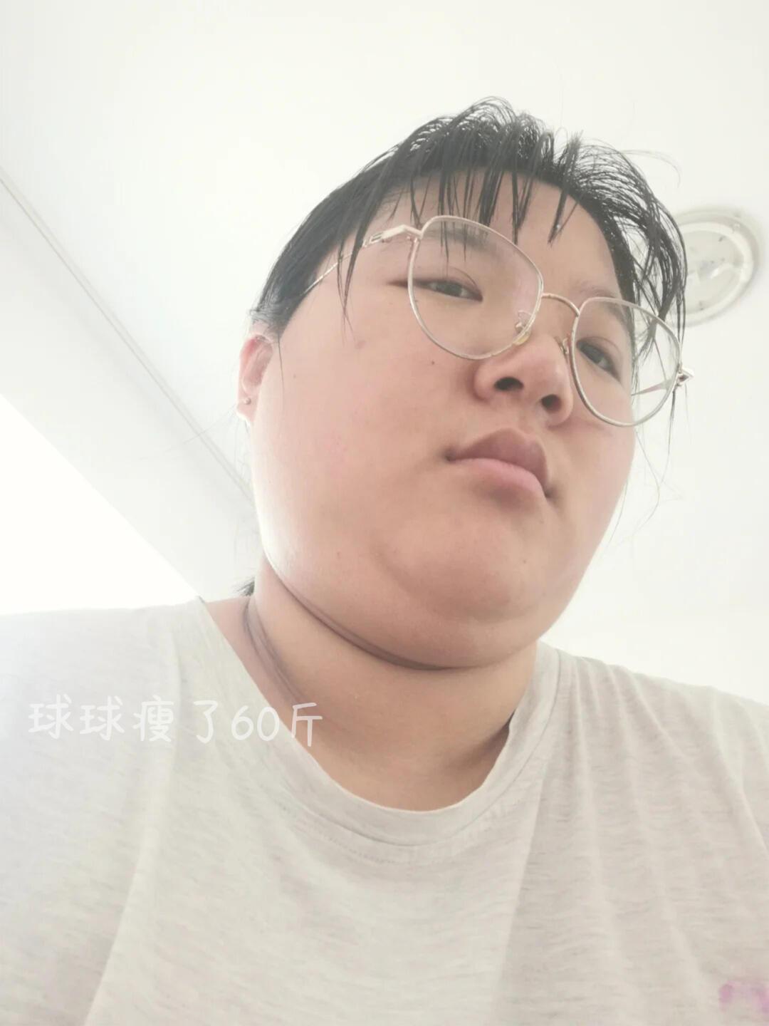 多囊，早睡+养雌1年，美貌已显化