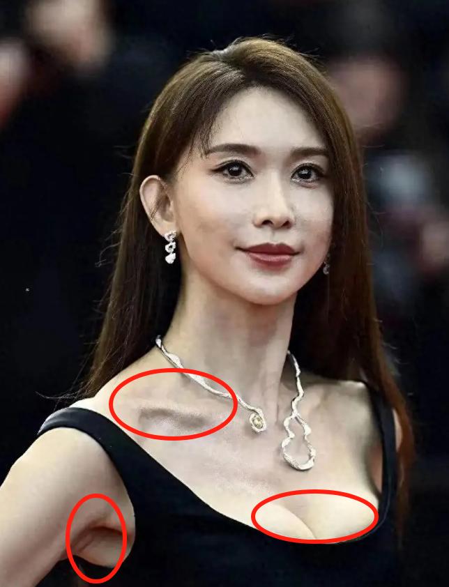 林志玲这是怎么了？近日，昔日名模林志玲现身戛纳红毯，看到她整个人瘦骨嶙峋，但
