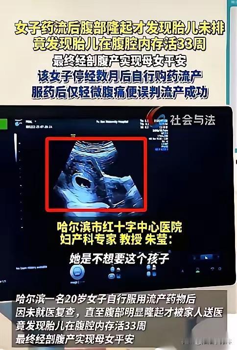 哈尔滨一个20岁的姑娘，吃药想把孩子打掉。结果B超探头一放上去，医生当场