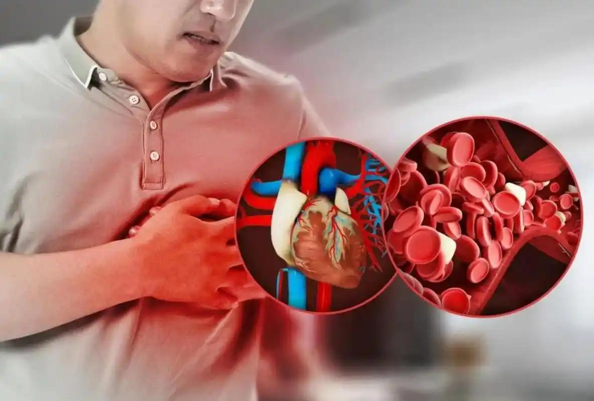 心梗不是突然倒下那么简单,它其实早就给过警告。但很多人不懂这些信号,等发现问题已